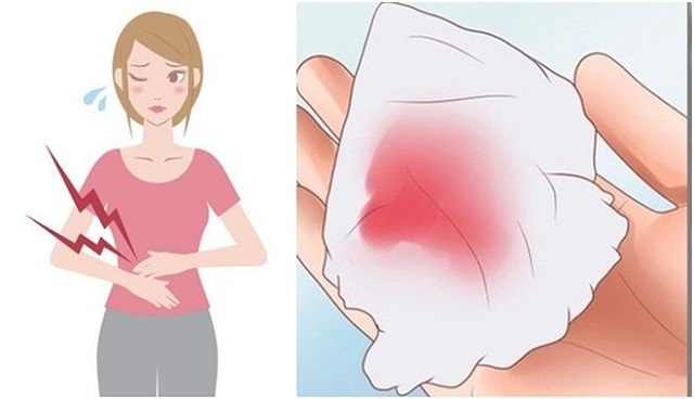 Bạn có thể bị đau bụng dưới và ra máu trong thời gian đầu khi mới đặt vòng.